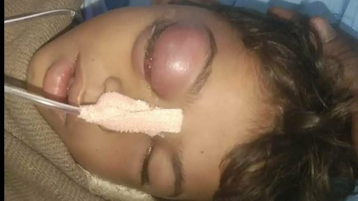 A nine year old Dalit boy died after he was beaten by his teacher in Rajasthan