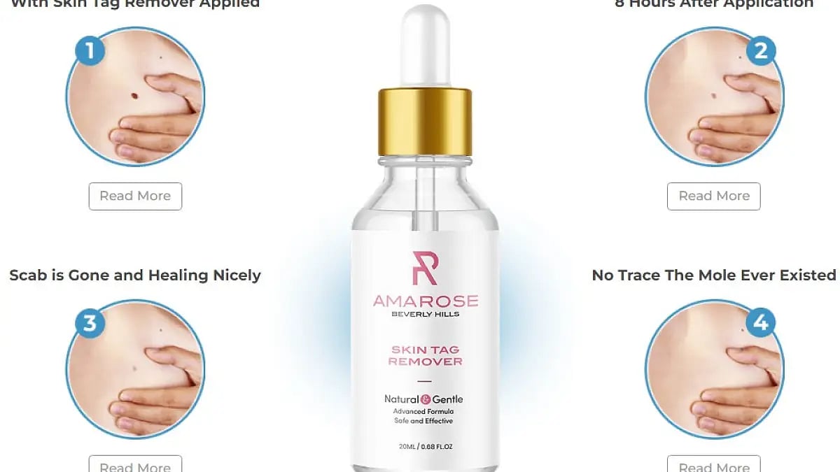 Amarose Skin Tag Remover Reviews 