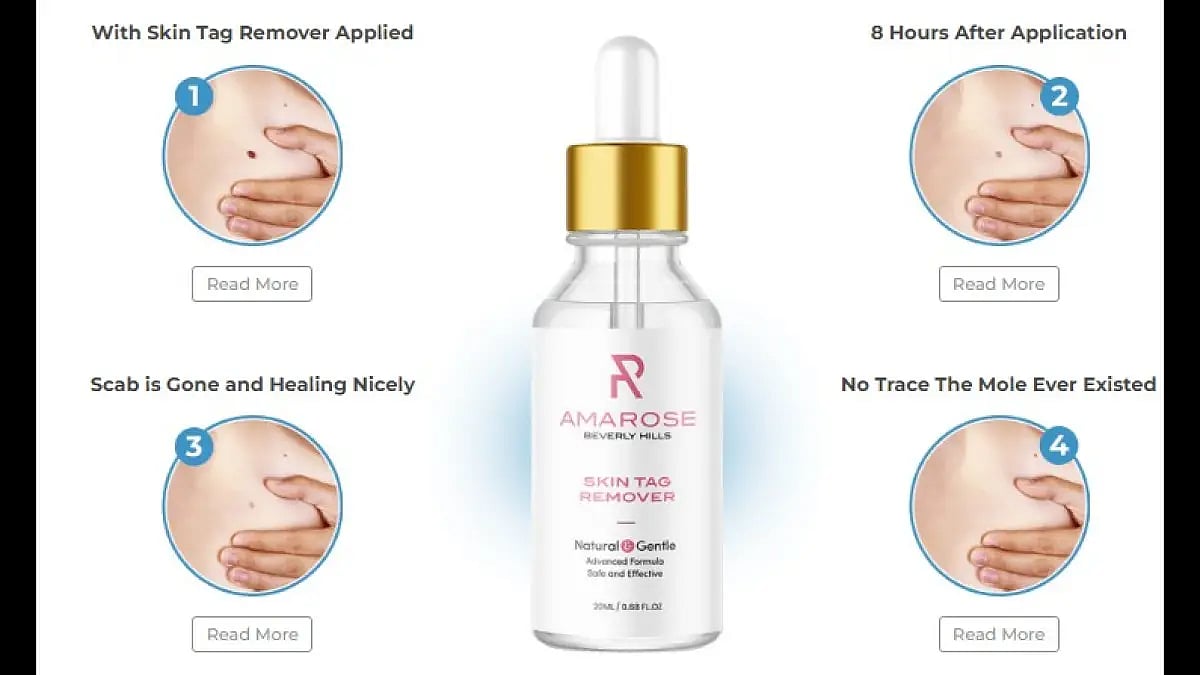 Amarose Skin Tag Remover