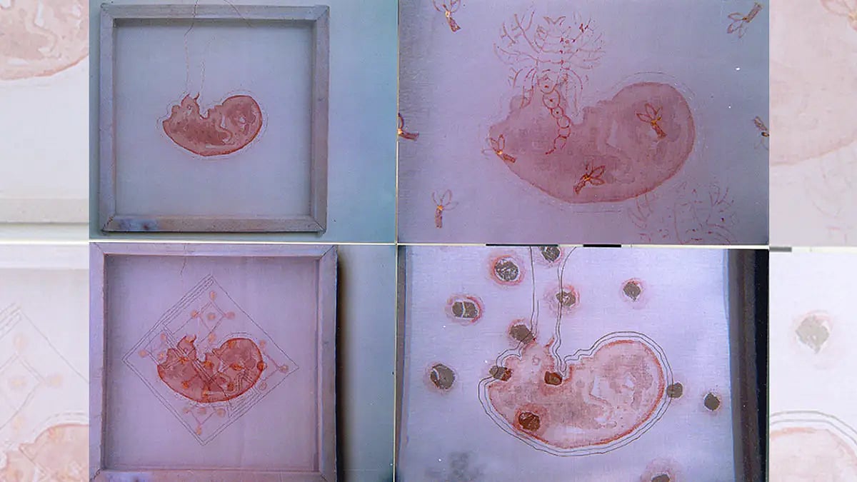 Why Indian Laws Need More Reforms To Provide Safe Abortions