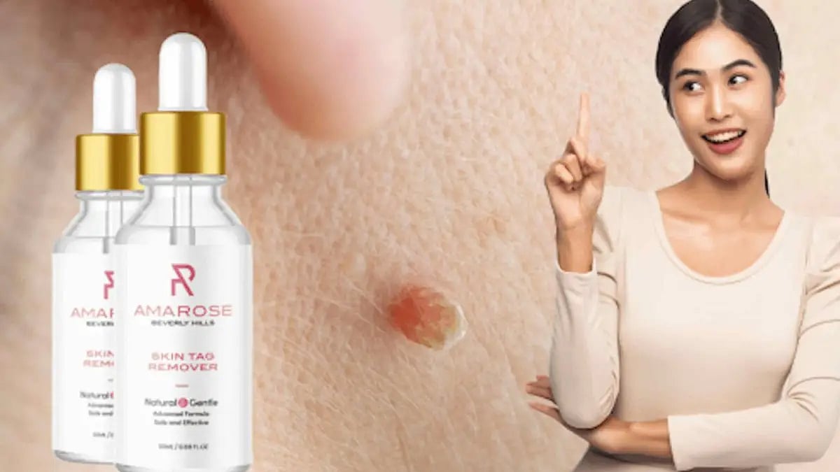 Amarose Skin Tag Remover Reviews