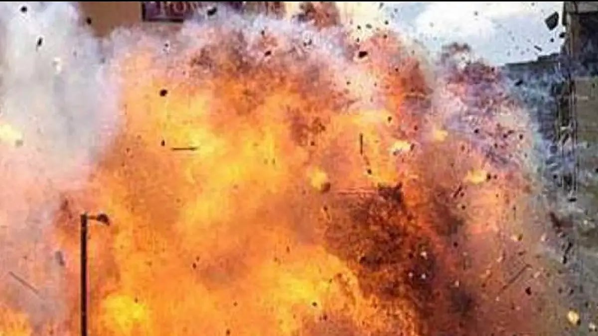 Representative photo