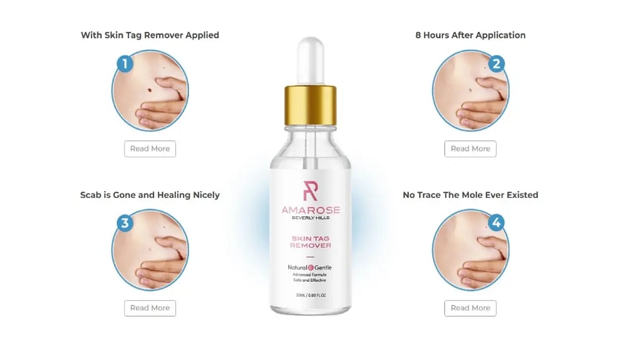 Amarose Skin Tag Remover