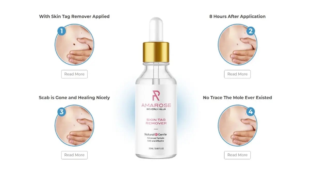 Amarose Skin Tag Remover