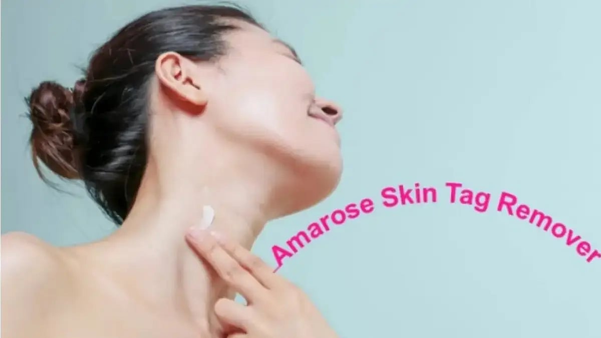 Amarose Skin Tag Remover