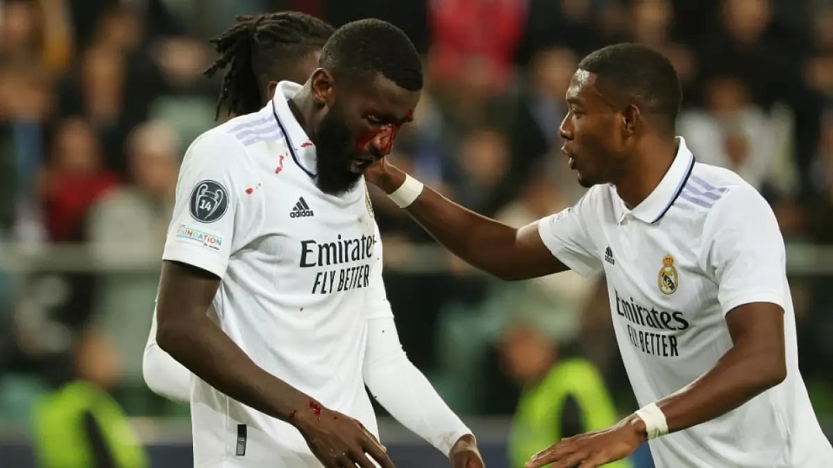 Blood runs down the face of Real Madrid's Antonio Rudiger during their UCL tie vs Shakhtar Donetsk.