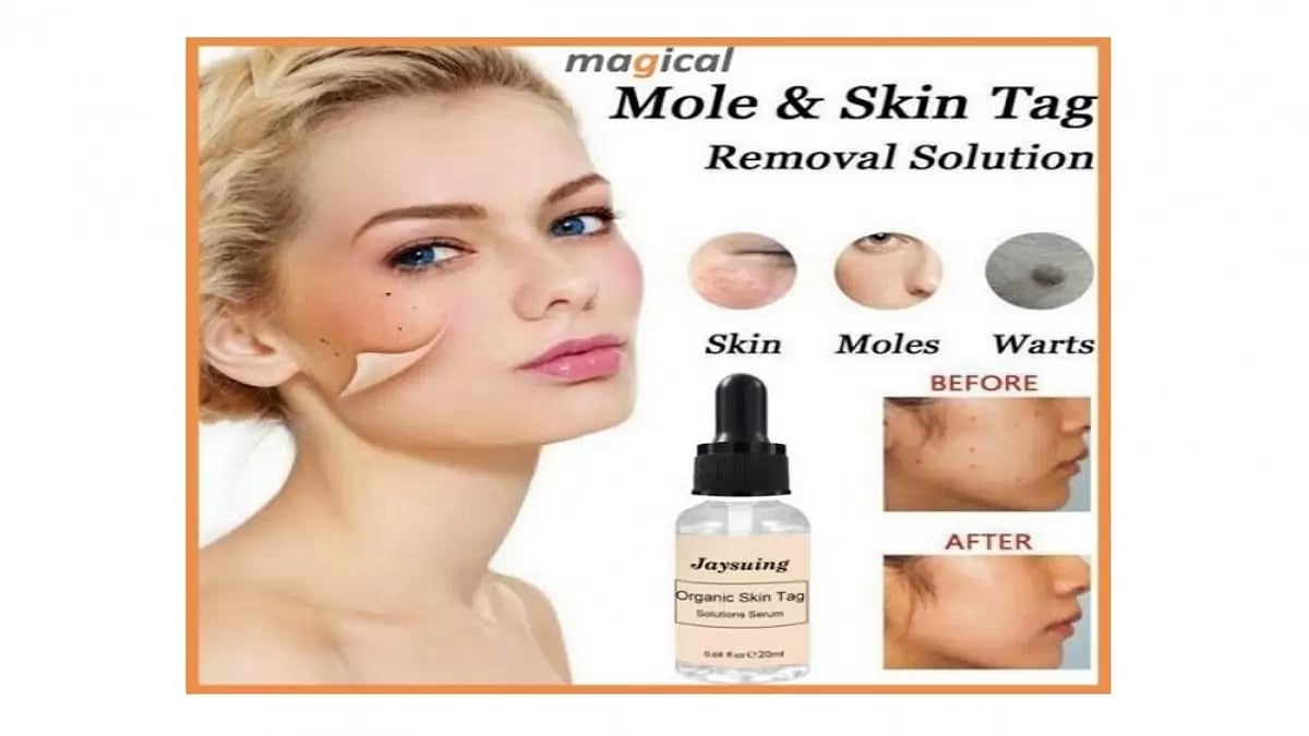 Amarose Skin Tag Remover
