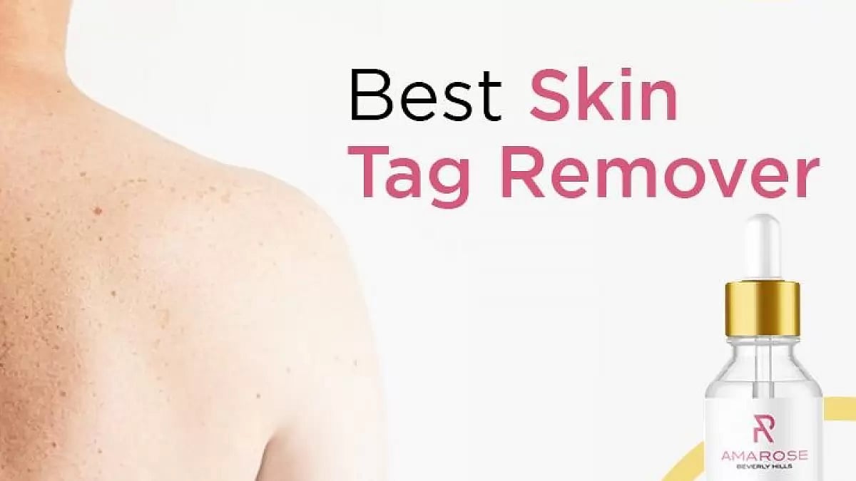 Amarose Skin Tag Remover