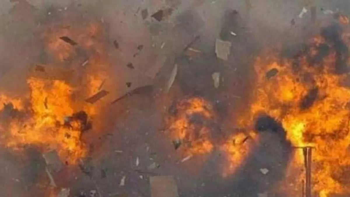 Representative image