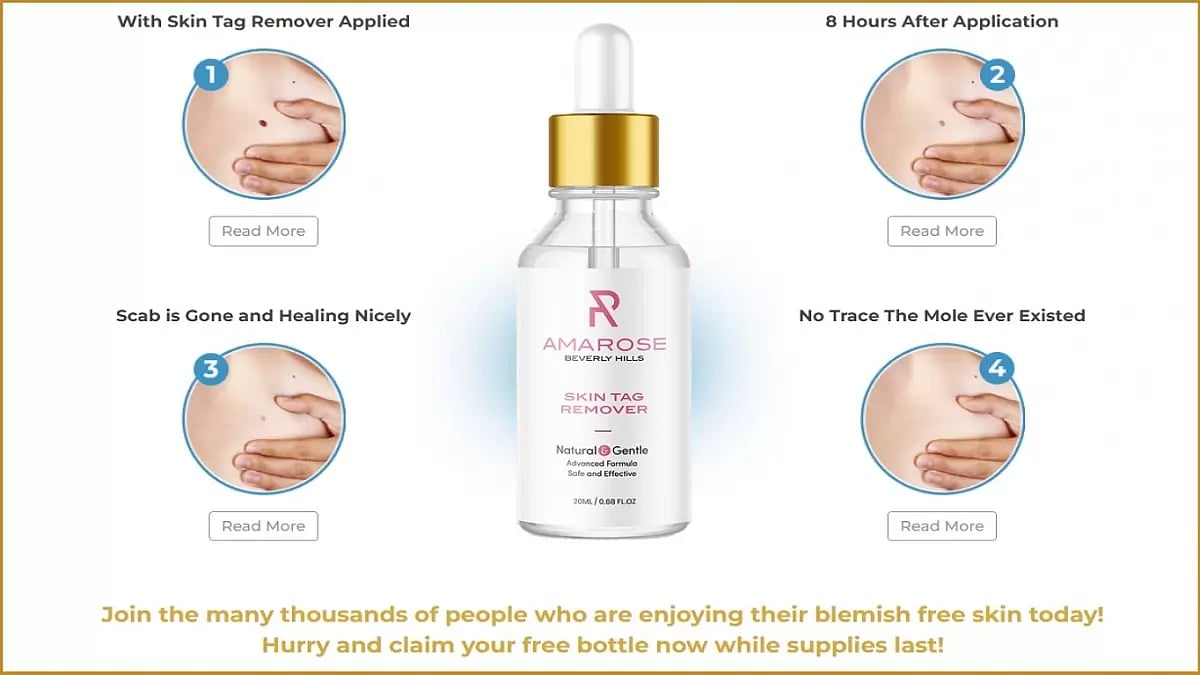 Amarose Skin Tag Remover
