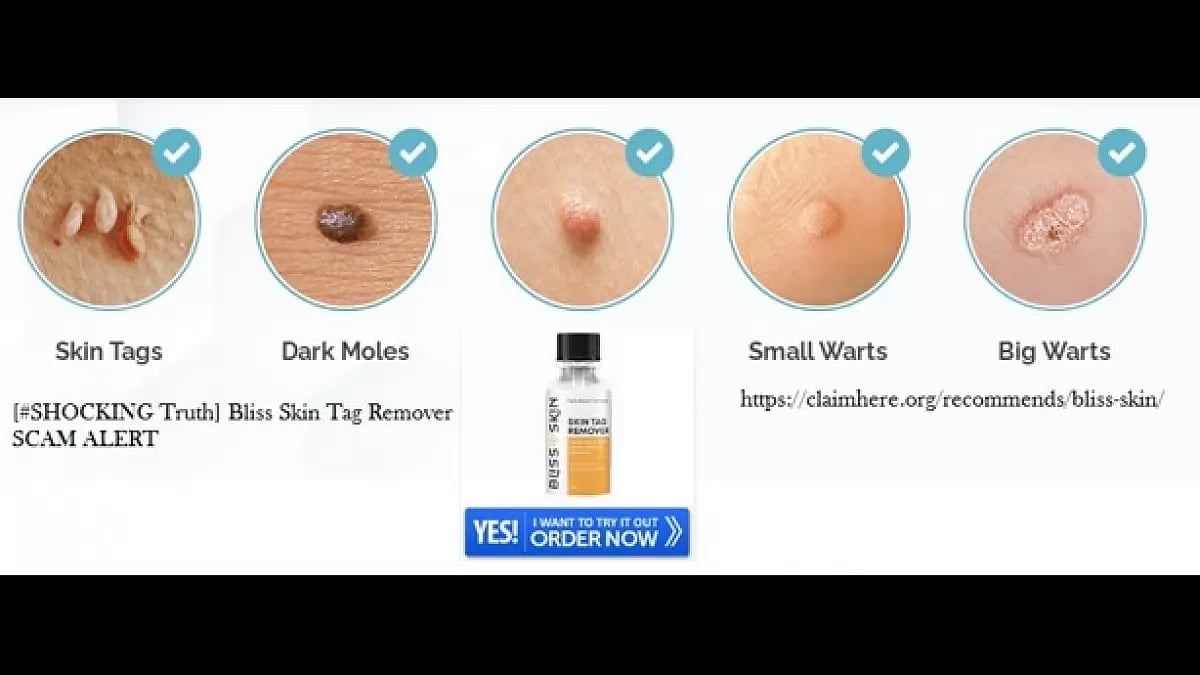 Bliss Skin Tag Remover