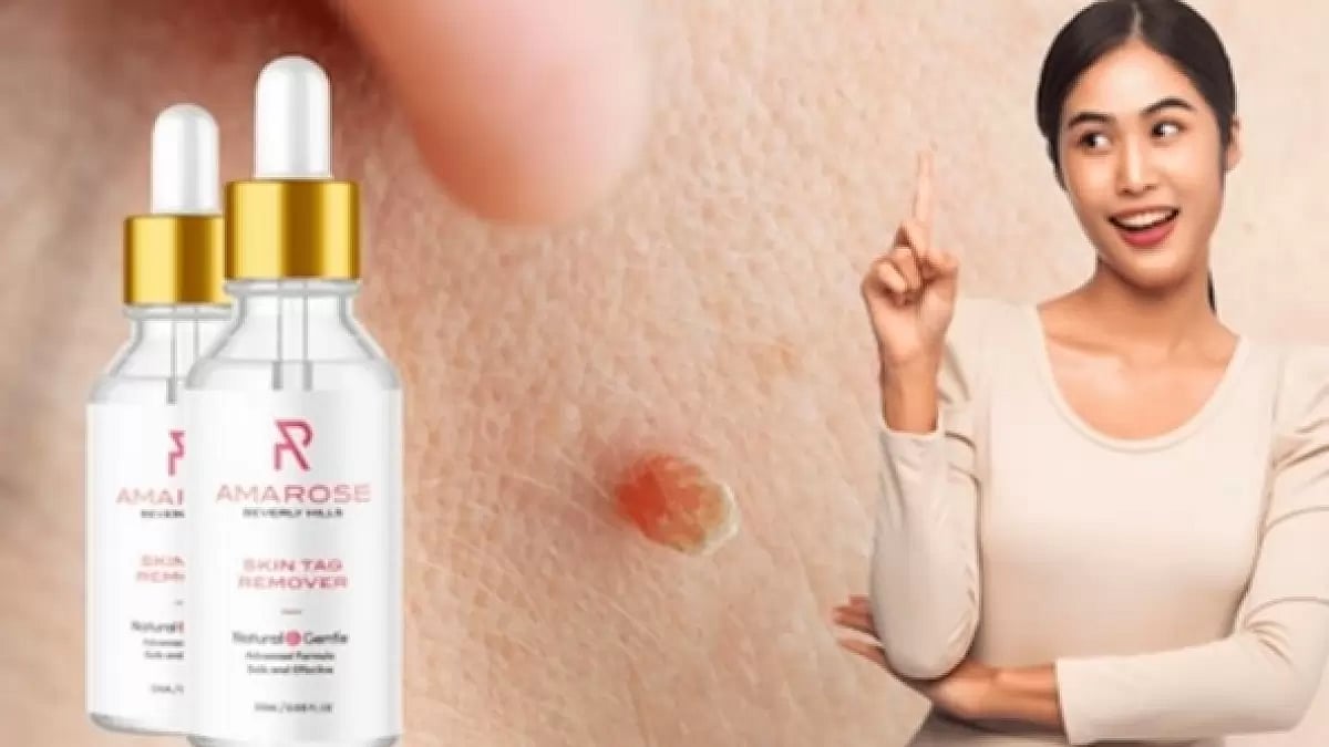 Amarose Skin Tag Remover