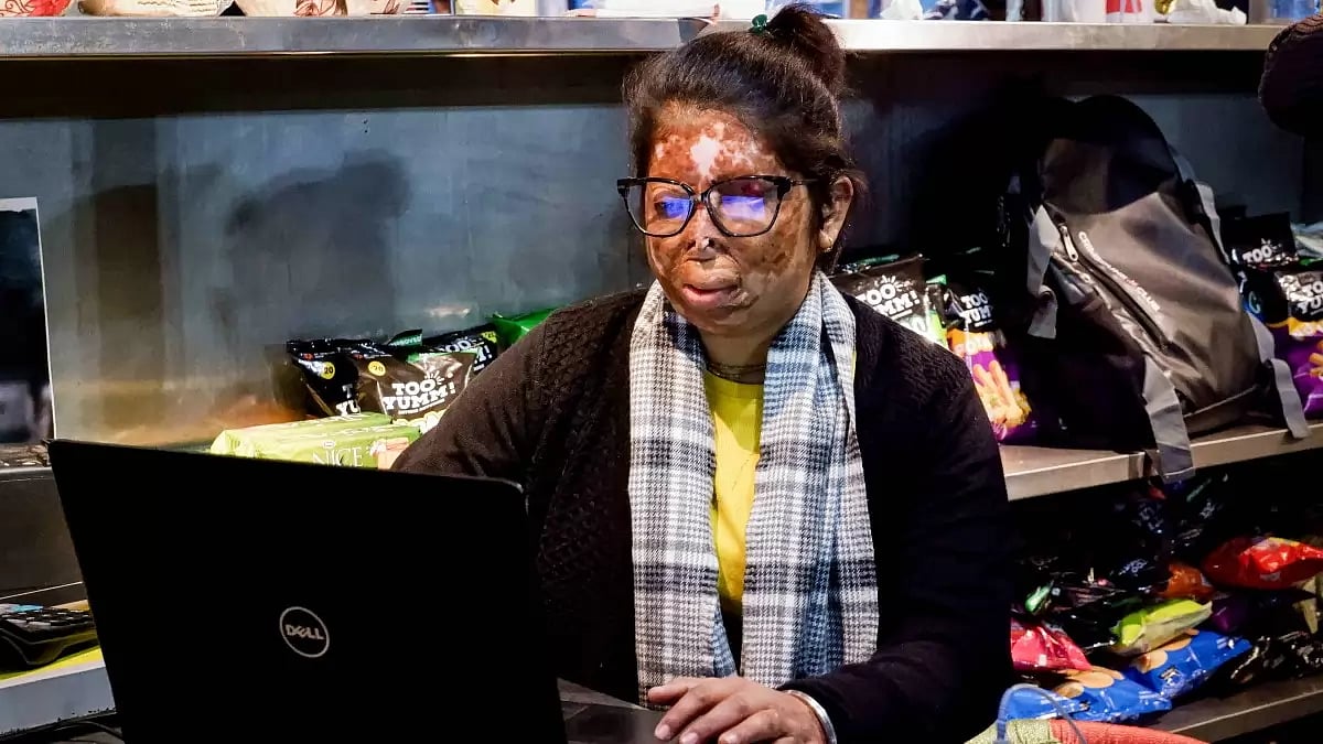 Acid attack survivor Anshu is now reach out manager of Chhanv foundation