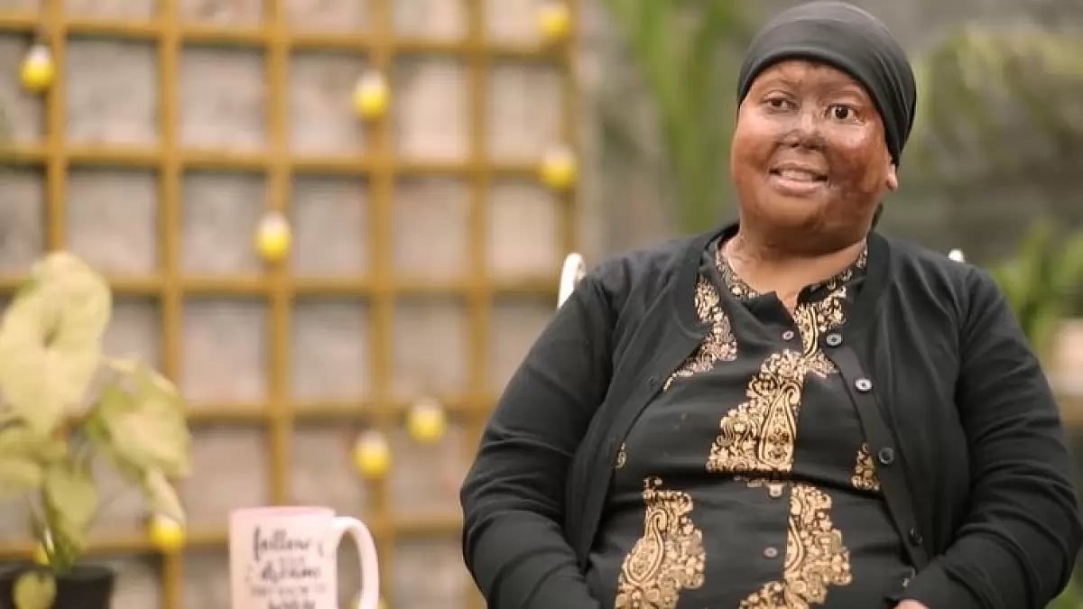 Acid attack survivor Pragya Prasun