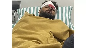 Pant sustained cuts on his forehead, a severely-bruised back along with injuries in his knee and ankle.