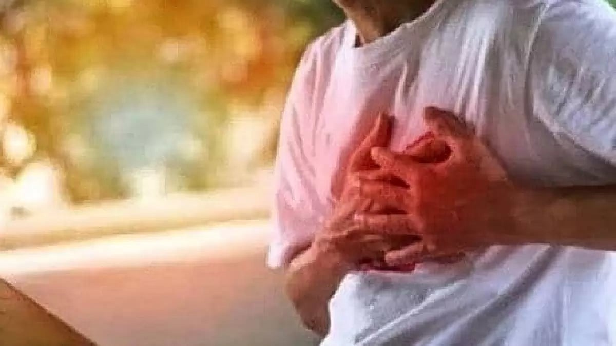 Representational Image