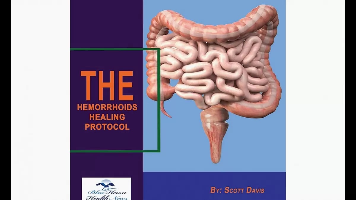 Hemorrhoids Healing Protocol Reviews