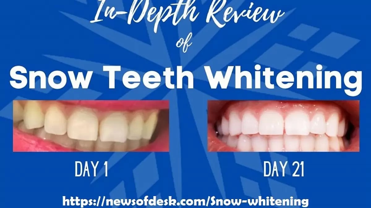 Snow Teeth Whitening Reviews 