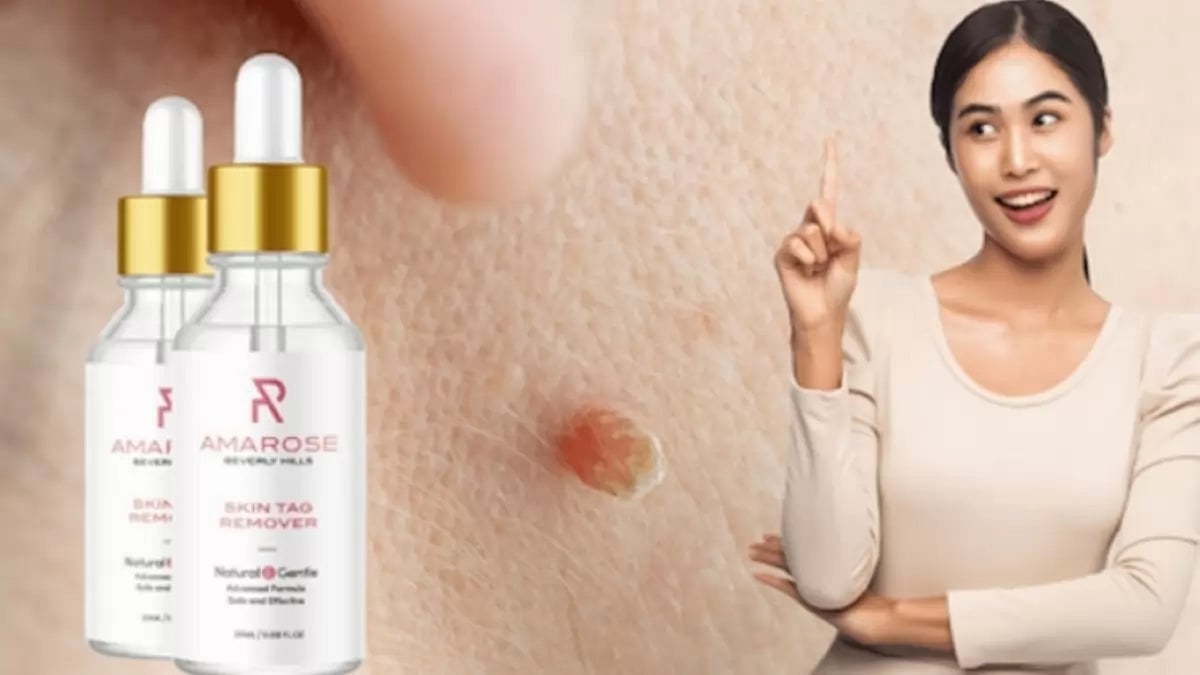 Amarose Skin Tag Remover