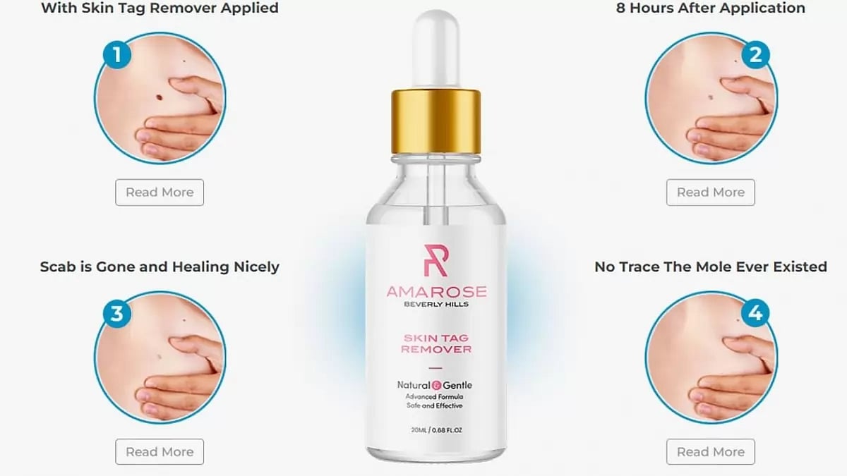 Amarose Skin Tag Remover