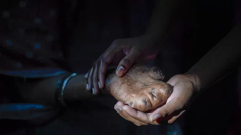 World Leprosy Day - null