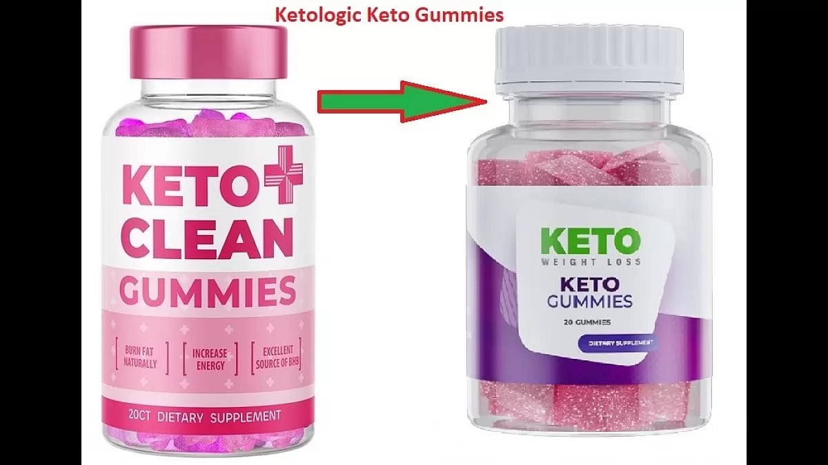 Ketologic Keto Gummies 
