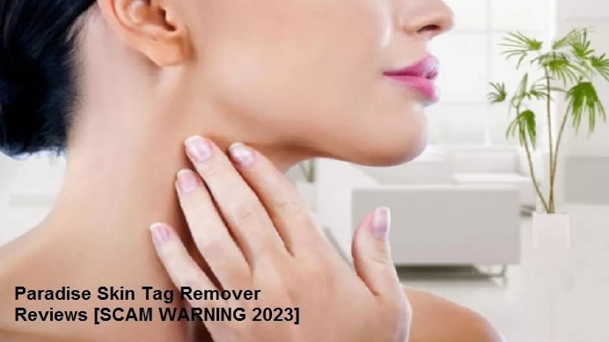 Paradise Skin Tag Remover