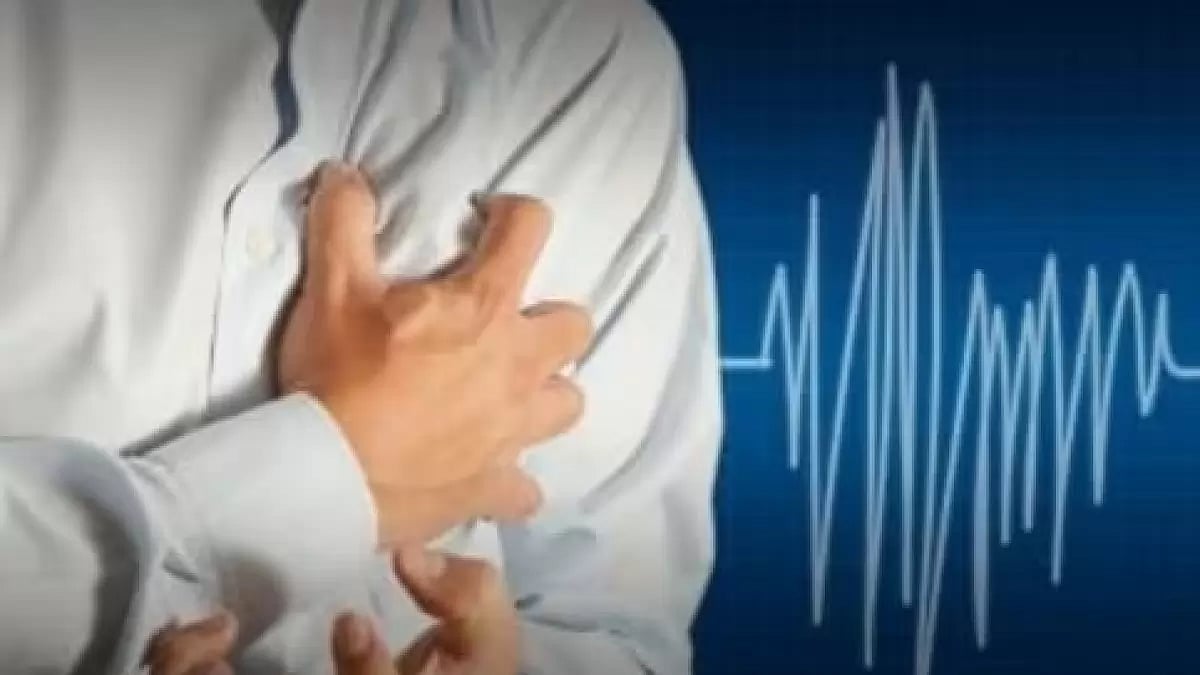 Representational Image