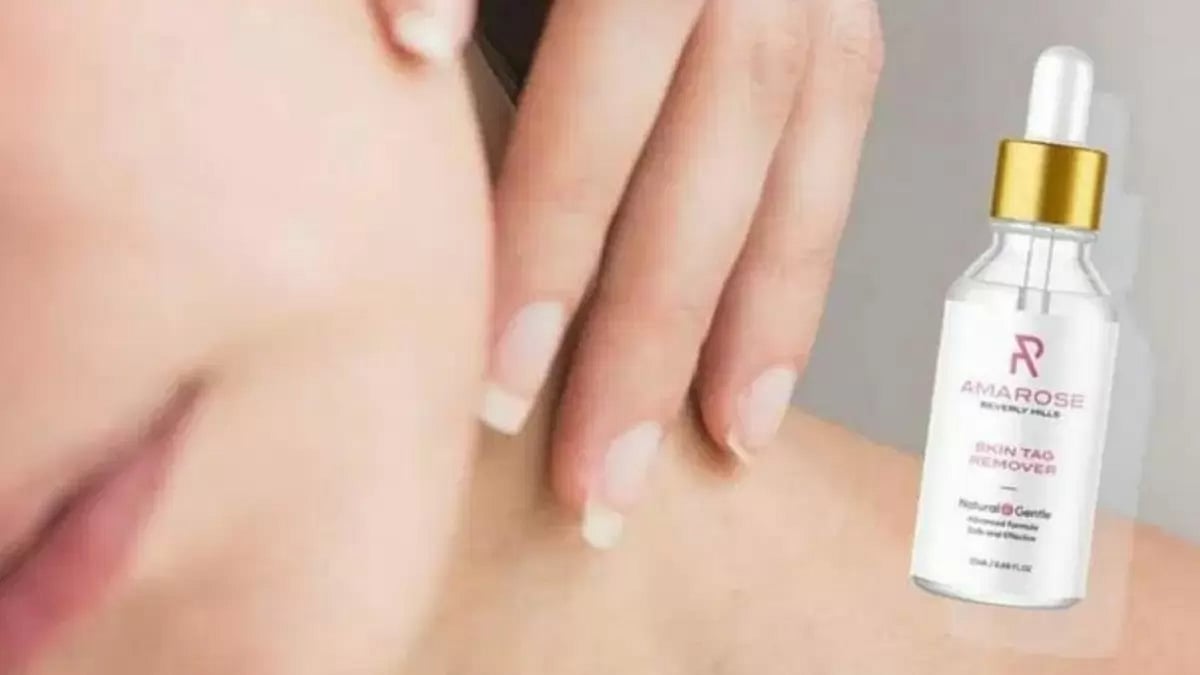 Flawless Perfect Skin Tag Remover 