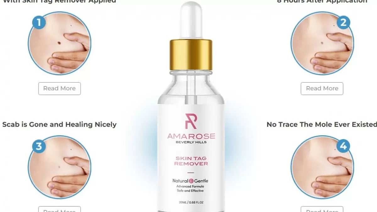 Super Luxe Skin Tag Remover