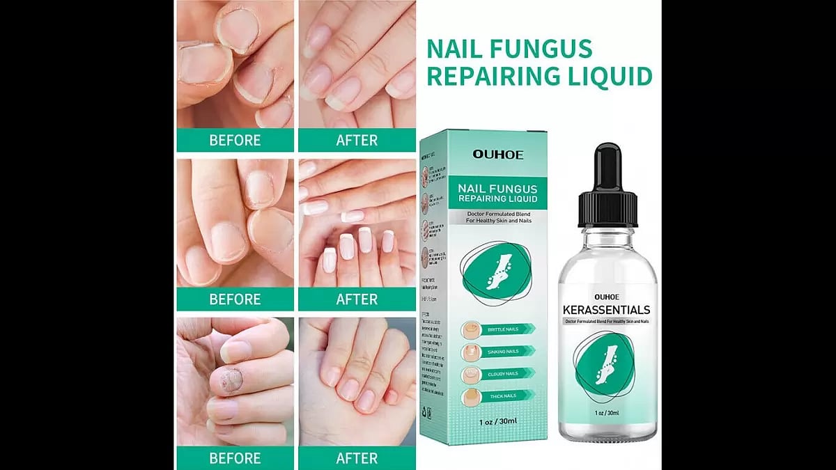 Kerassentials Reviews 