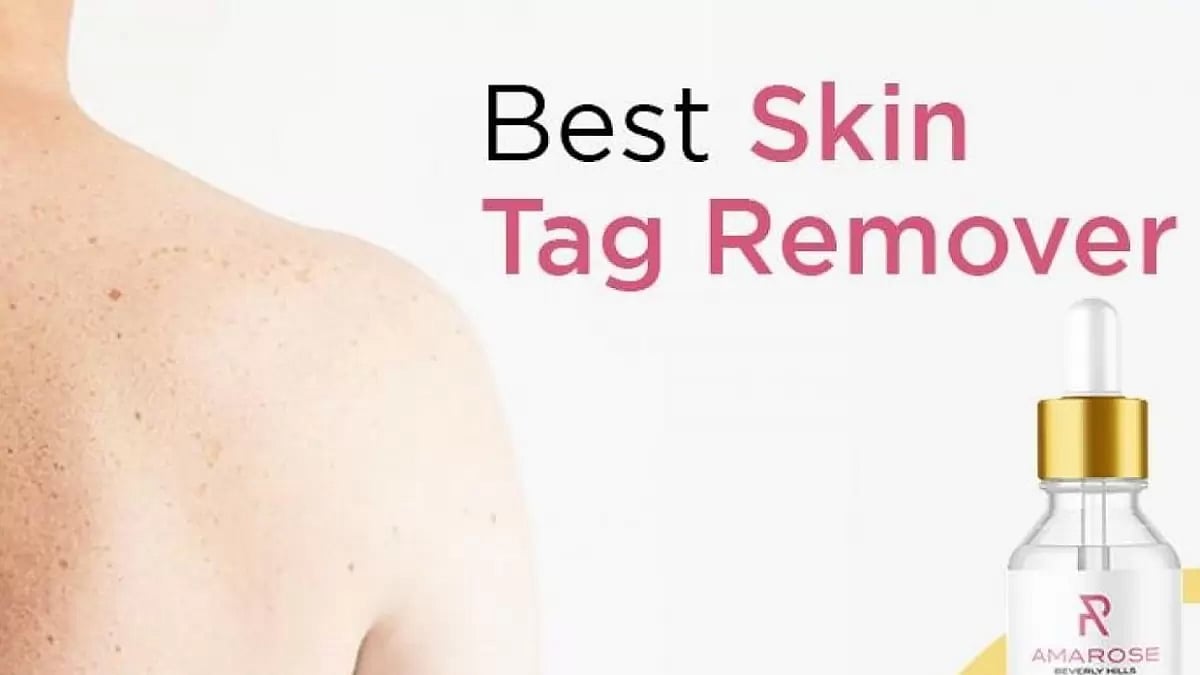 Gold Coast Skin Tag Remover 