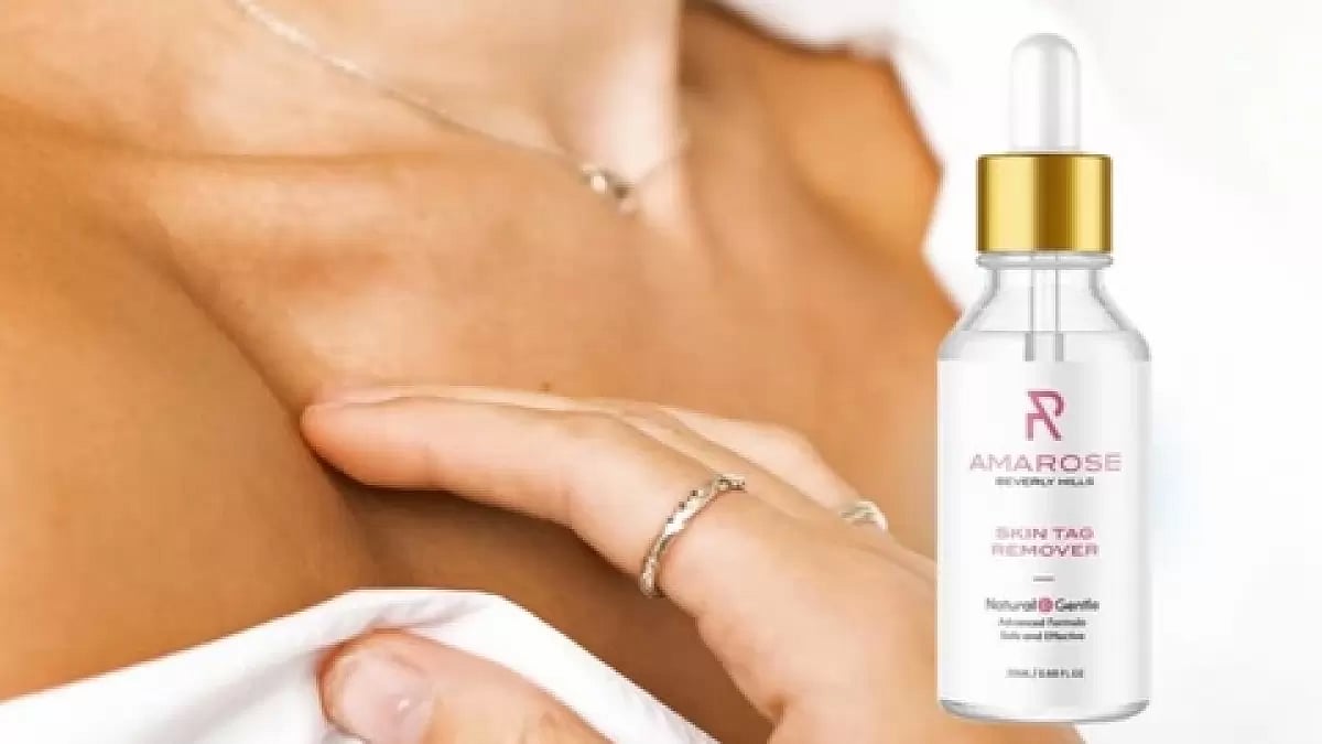 Amarose Skin Tag Remover 