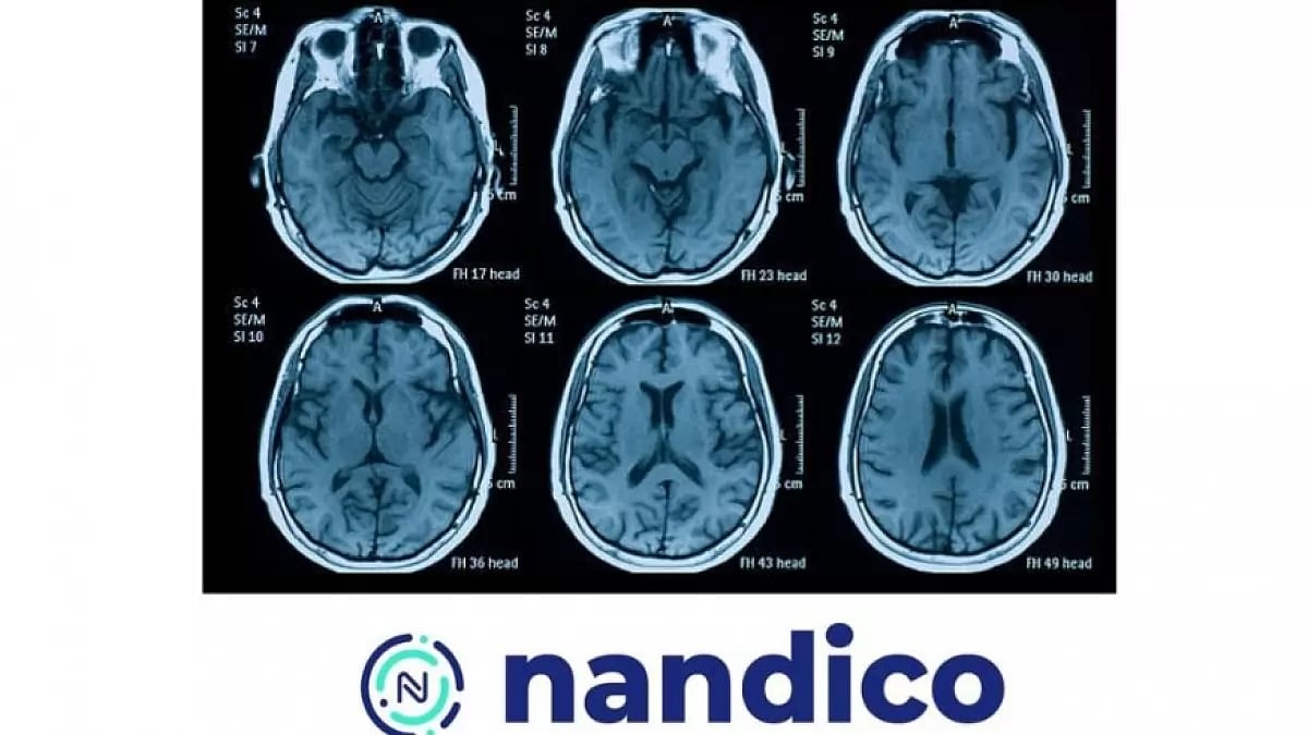NANDICO: Revolutionizing Radiology with Cloud based technology.