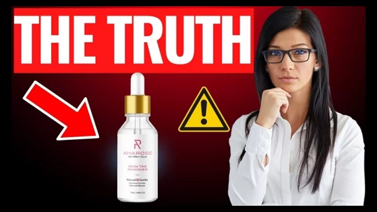 So Smooth Skin Tag Remover