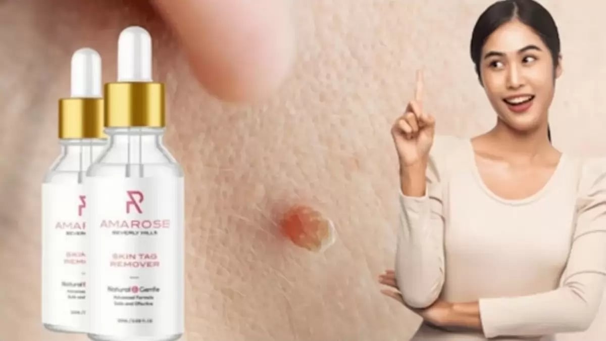 Skin Tag Remover