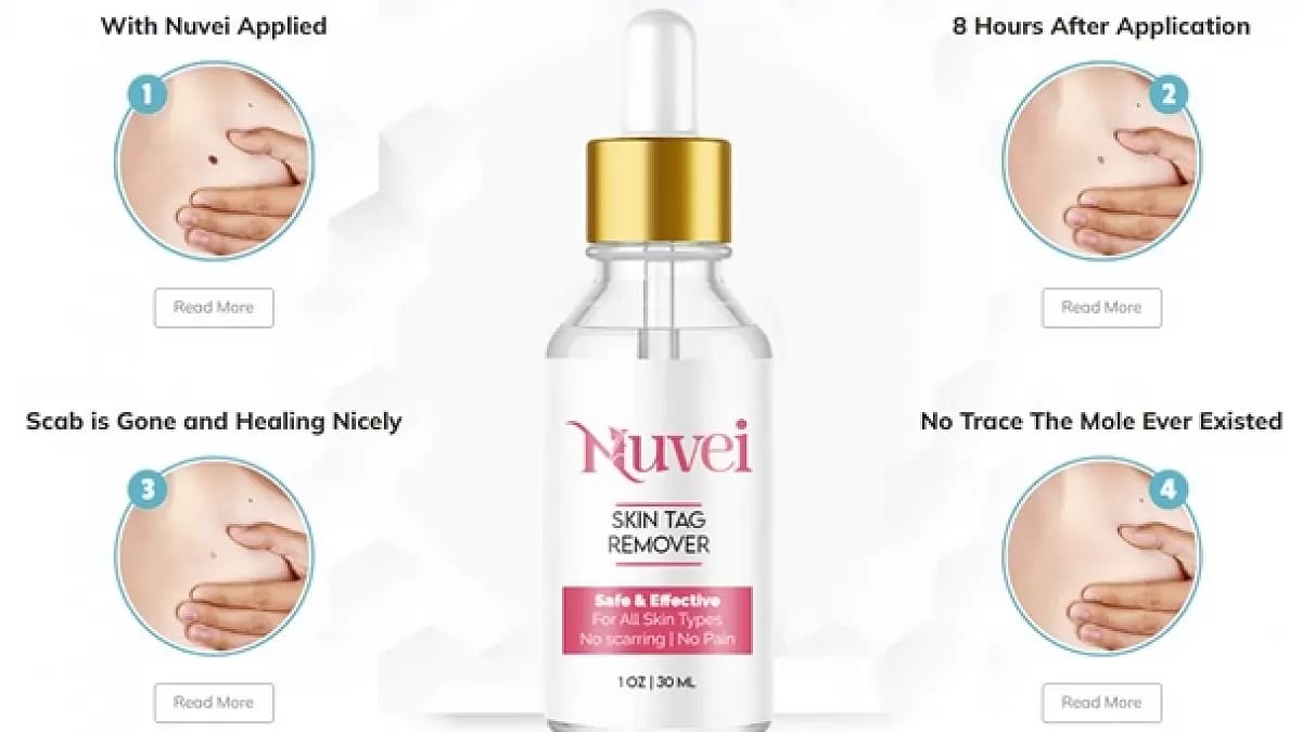 Nuvei Skin Tag Remover