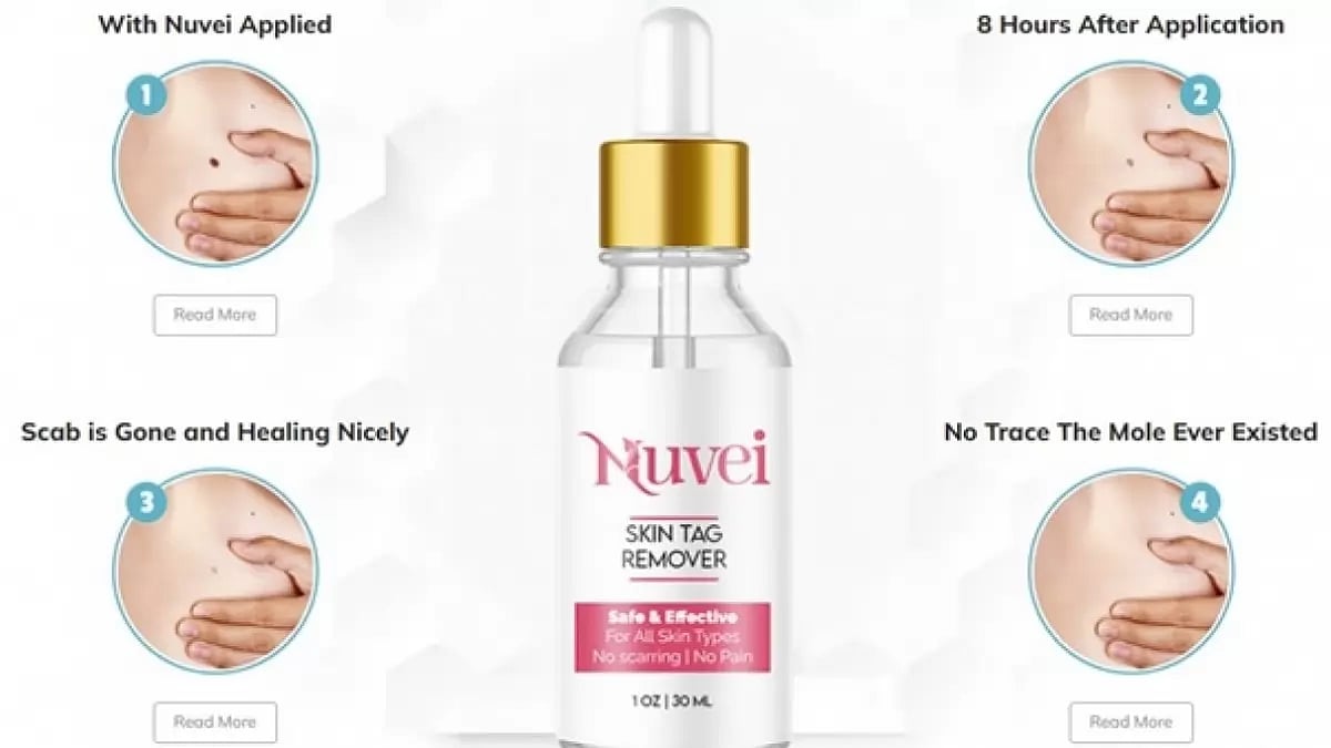 Nuvei Skin Tag Remover