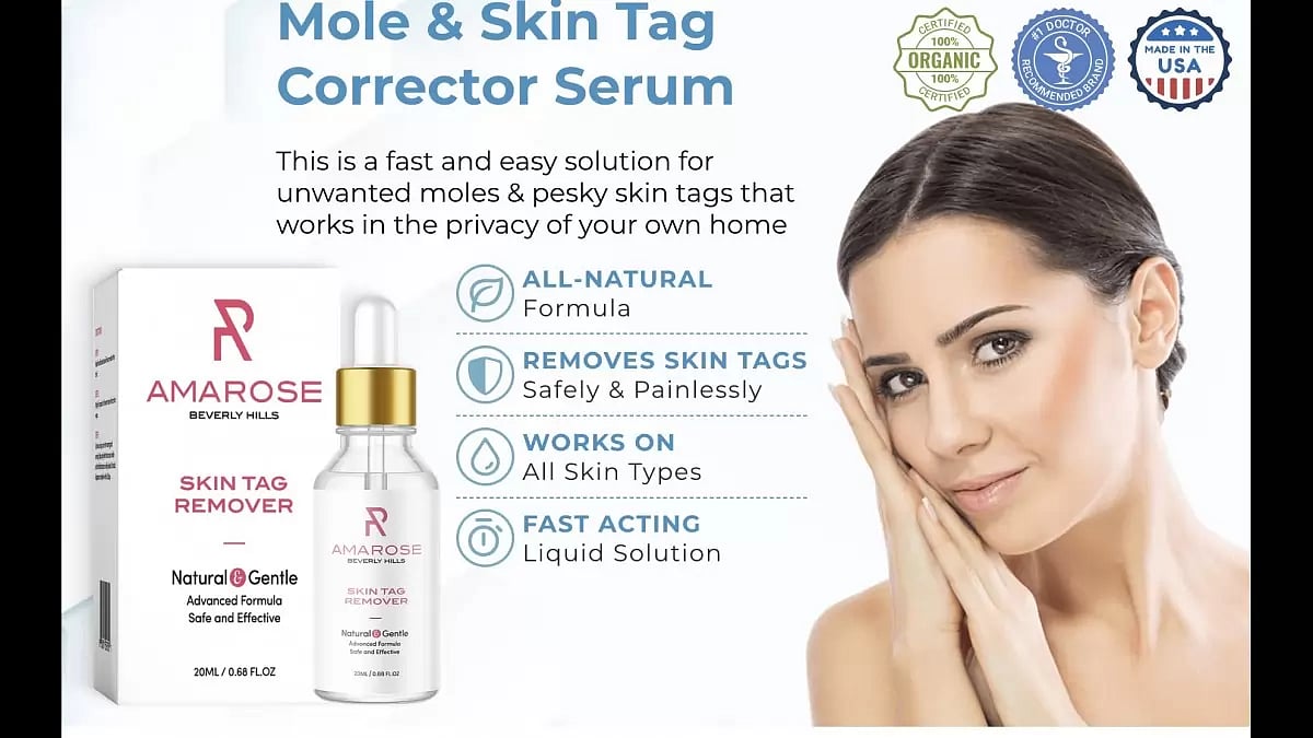 Amarose Skin Tag Remover 