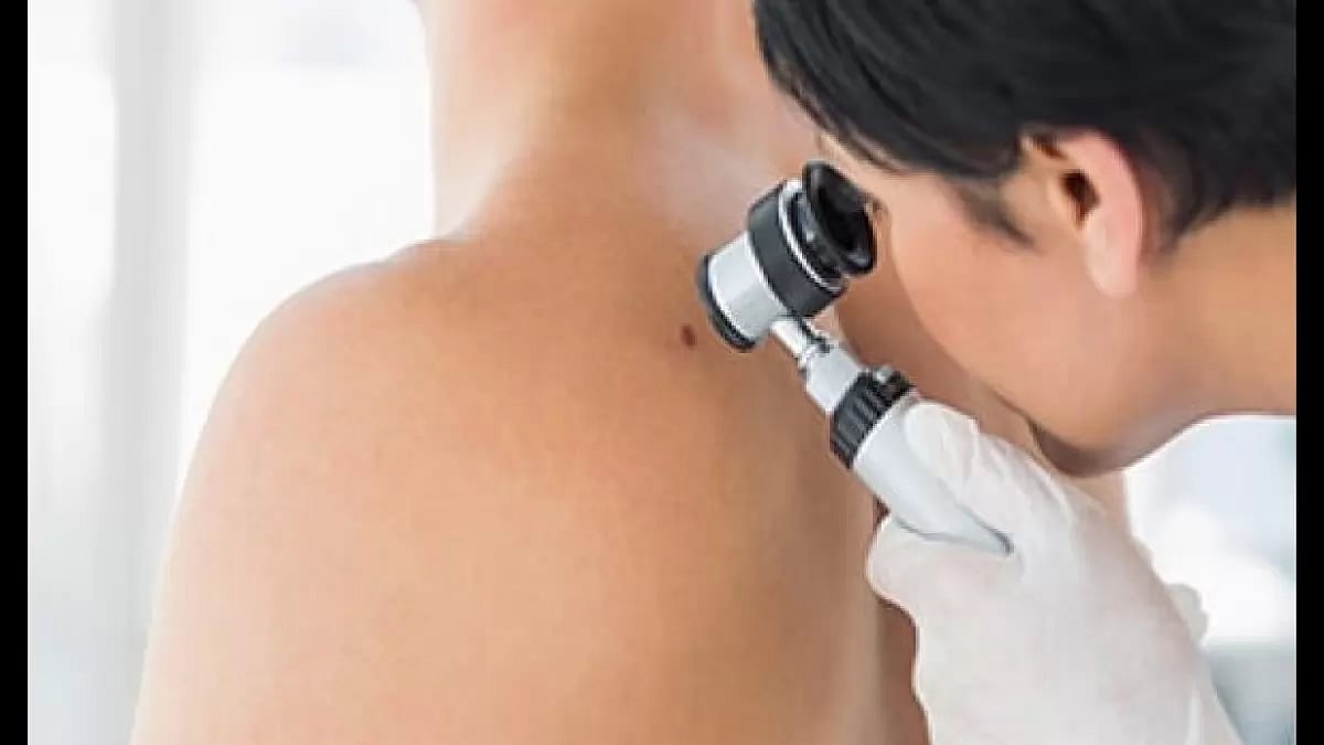 Radiant Cutis Skin Tag Remover