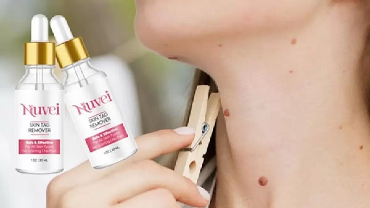 Nuvei Skin Tag Remover 