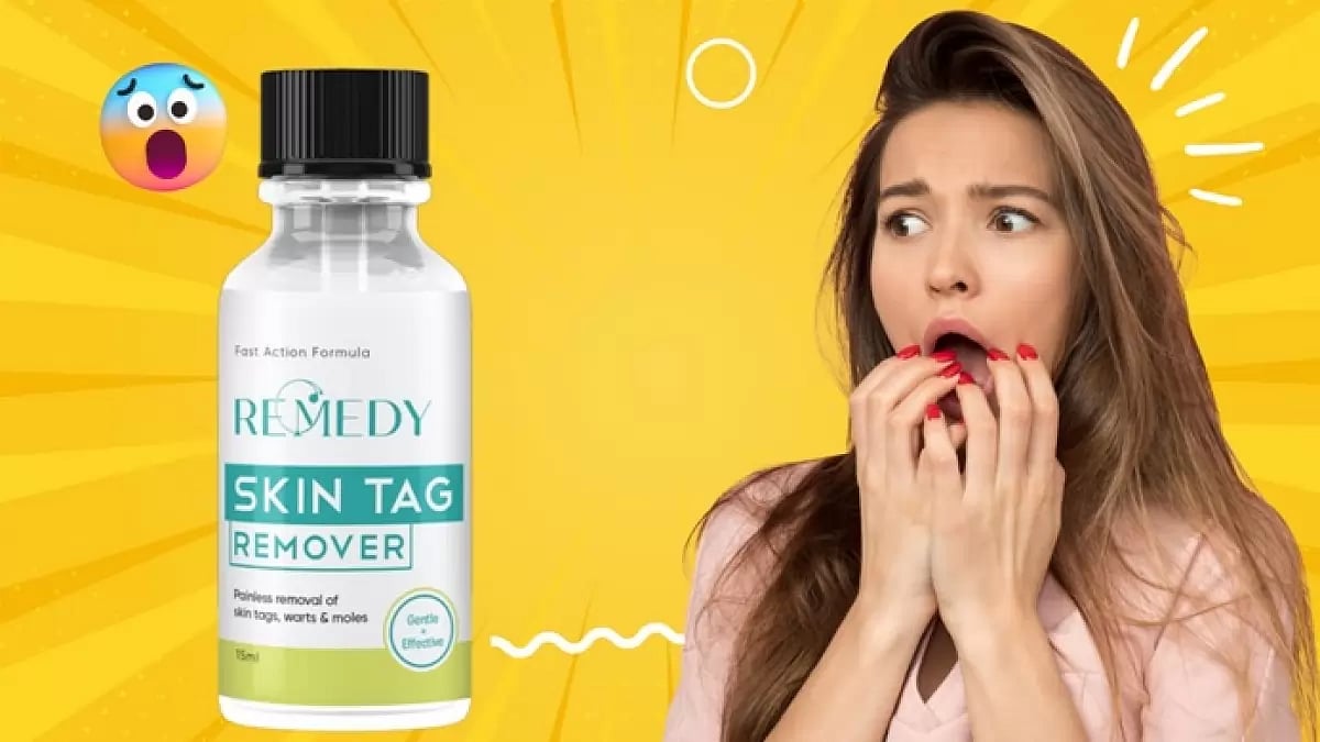 Remedy Skin Tag Remover