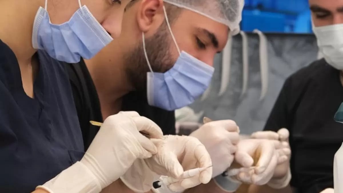 Turkish Hair Transplant Clinic Of 2023