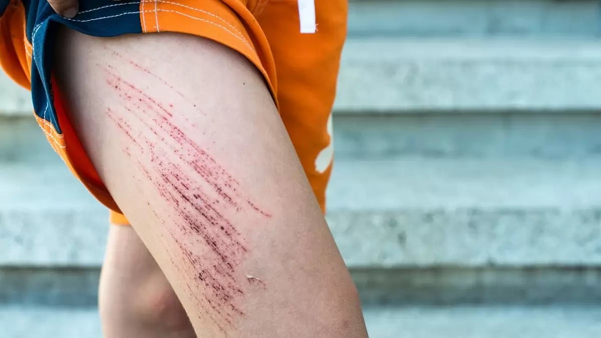 Healing Properties Of BPC 157