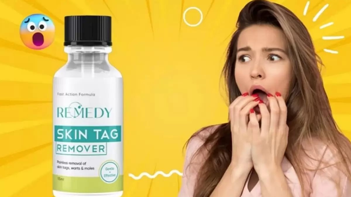 Remedy Skin Tag Remover