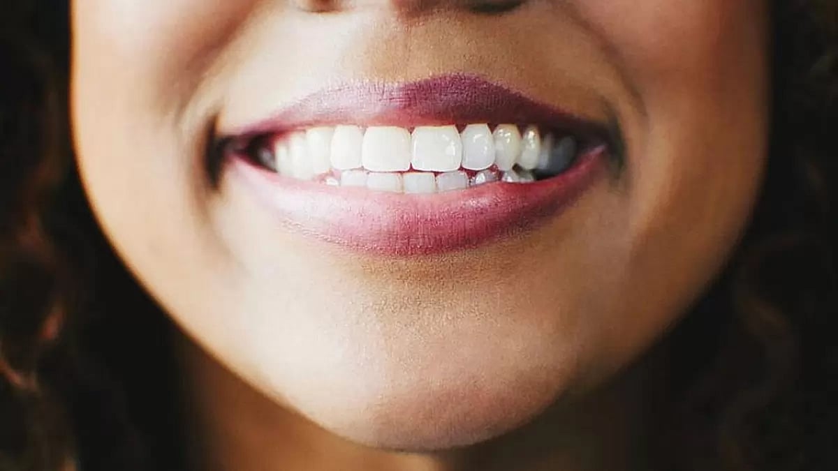 Best Dental Supplements