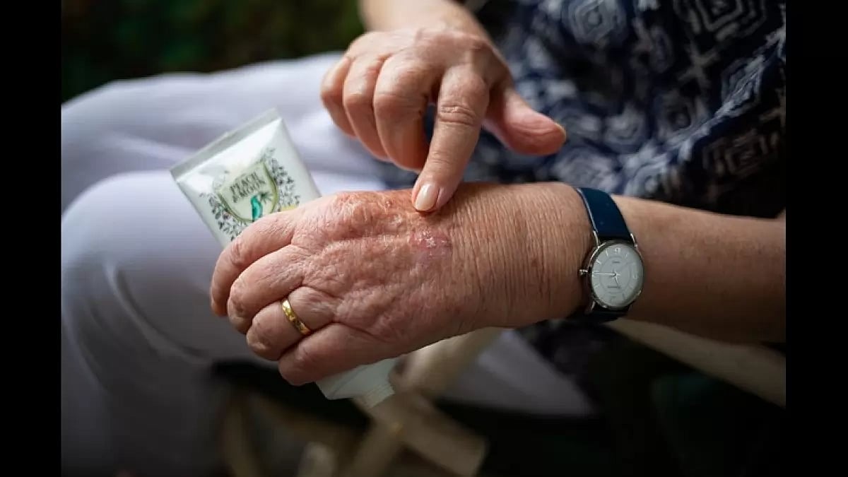 Best Arthritis Supplement