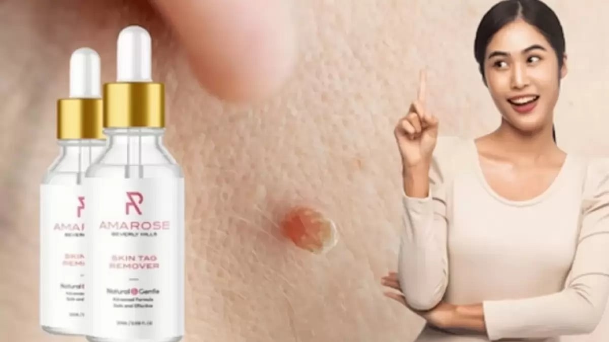 Amarose Skin Tag Remover