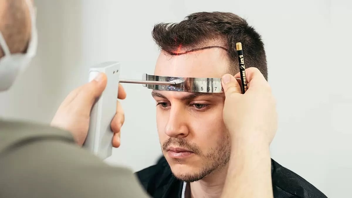 Hair Transplant Clinics