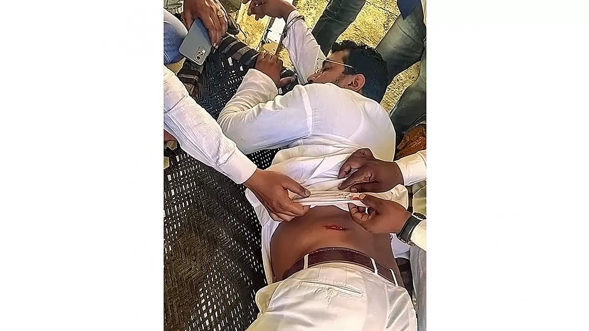 Chandrashekhar Azad sustained minor bullet injuries